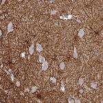 Thimet Oligopeptidase Polyclonal Antibody