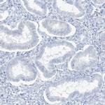 AGXT Antibody in Immunohistochemistry (Paraffin) (IHC (P))