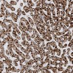 AGXT Antibody in Immunohistochemistry (Paraffin) (IHC (P))