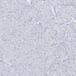 AGXT Polyclonal Antibody