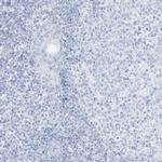 AGXT Antibody in Immunohistochemistry (Paraffin) (IHC (P))