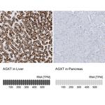 AGXT Antibody