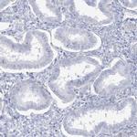 AGXT Antibody in Immunohistochemistry (Paraffin) (IHC (P))