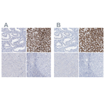 AGXT Antibody in Immunohistochemistry (Paraffin) (IHC (P))