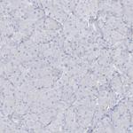 AGXT Antibody in Immunohistochemistry (Paraffin) (IHC (P))