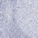 AGXT Antibody in Immunohistochemistry (Paraffin) (IHC (P))