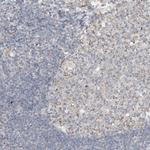 SFMBT2 Antibody in Immunohistochemistry (Paraffin) (IHC (P))