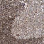 SFMBT2 Polyclonal Antibody