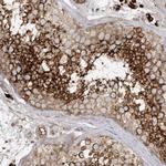 HIPPI Antibody in Immunohistochemistry (Paraffin) (IHC (P))