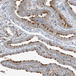 HIPPI Polyclonal Antibody