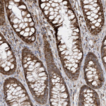 HIPPI Antibody in Immunohistochemistry (Paraffin) (IHC (P))