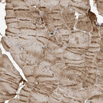 HIPPI Antibody in Immunohistochemistry (Paraffin) (IHC (P))