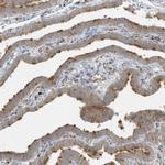 HIPPI Polyclonal Antibody