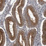 STAM2 Antibody in Immunohistochemistry (Paraffin) (IHC (P))