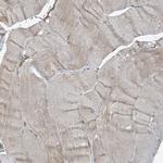 STAM2 Antibody in Immunohistochemistry (Paraffin) (IHC (P))