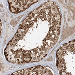 STAM2 Antibody in Immunohistochemistry (Paraffin) (IHC (P))