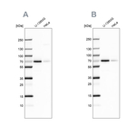 STAM2 Antibody in Western Blot (WB)