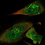 STAM2 Polyclonal Antibody