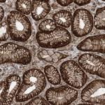 STAM2 Antibody in Immunohistochemistry (Paraffin) (IHC (P))