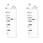 STAM2 Antibody in Western Blot (WB)
