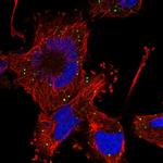 HFM1 Polyclonal Antibody