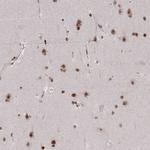 CDYL Antibody in Immunohistochemistry (Paraffin) (IHC (P))