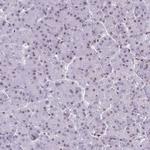 CDYL Antibody in Immunohistochemistry (Paraffin) (IHC (P))