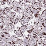 CDYL Antibody in Immunohistochemistry (Paraffin) (IHC (P))