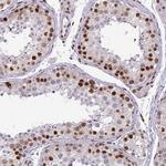CDYL Antibody in Immunohistochemistry (Paraffin) (IHC (P))