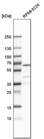 CDYL Antibody in Western Blot (WB)