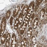 EDF1 Antibody in Immunohistochemistry (Paraffin) (IHC (P))
