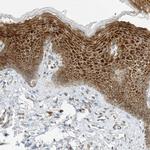 EDF1 Antibody in Immunohistochemistry (Paraffin) (IHC (P))