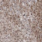 TPRKB Antibody in Immunohistochemistry (Paraffin) (IHC (P))