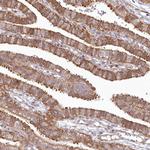 SH2D3A Antibody in Immunohistochemistry (Paraffin) (IHC (P))