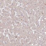 SH2D3A Antibody in Immunohistochemistry (Paraffin) (IHC (P))