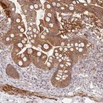 SH2D3A Antibody in Immunohistochemistry (Paraffin) (IHC (P))