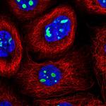 NIFK Polyclonal Antibody