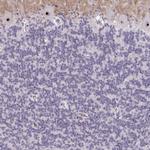 NIFK Antibody in Immunohistochemistry (Paraffin) (IHC (P))