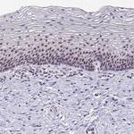 NIFK Antibody in Immunohistochemistry (Paraffin) (IHC (P))