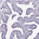 NIFK Antibody in Immunohistochemistry (Paraffin) (IHC (P))
