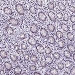 NIFK Antibody in Immunohistochemistry (Paraffin) (IHC (P))