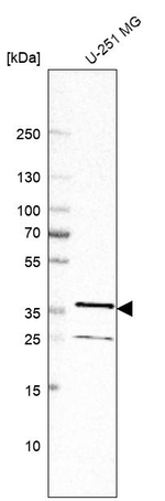 NIFK Antibody in Western Blot (WB)