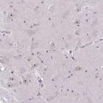 NIFK Polyclonal Antibody