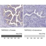 TMPRSS2 Antibody