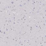 TMPRSS2 Antibody in Immunohistochemistry (Paraffin) (IHC (P))