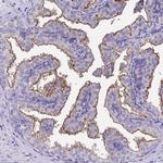 TMPRSS2 Antibody in Immunohistochemistry (Paraffin) (IHC (P))