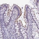 TMPRSS2 Antibody in Immunohistochemistry (Paraffin) (IHC (P))