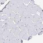 TMPRSS2 Antibody in Immunohistochemistry (Paraffin) (IHC (P))