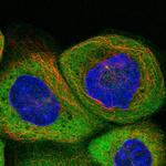 GTPBP9 Polyclonal Antibody