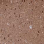 GTPBP9 Antibody in Immunohistochemistry (Paraffin) (IHC (P))